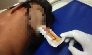Mencekam! Warga Dibacok Motor Dibakar, Warung Dirusak: Pelaku Belum Ditangkap